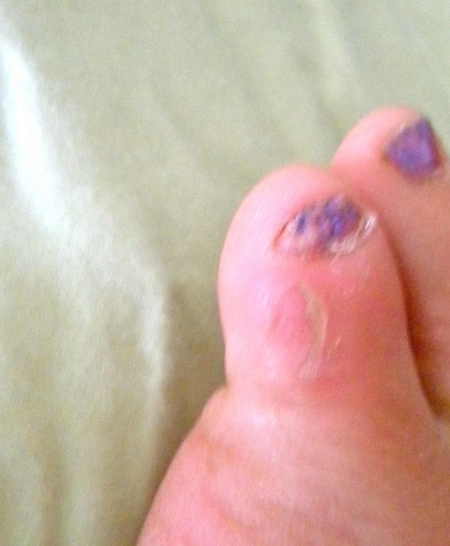 My Pinky Toe Nail Is Black 110